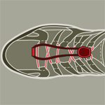 MCK Fast lace system